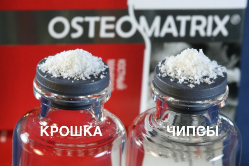 Остеоматрикс крошка (~0,25-1,0 мм) фото 3